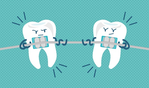 Orthodontie enfant