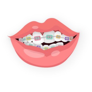 bonne mutuelle orthodontie adulte bonne mutuelle orthodontie adulte